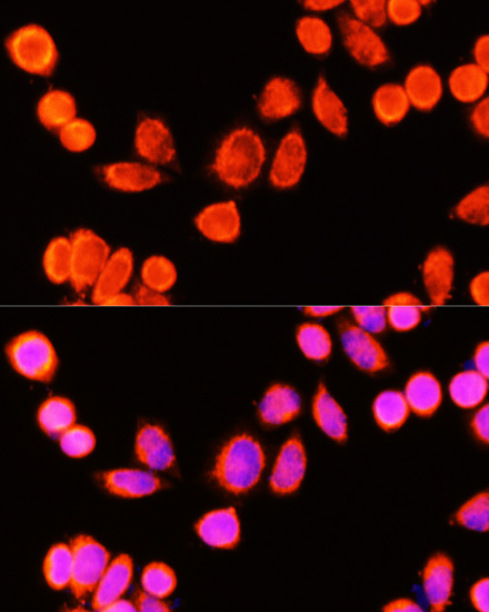 GSTK1 Polyclonal Antibody (E-AB-92371)