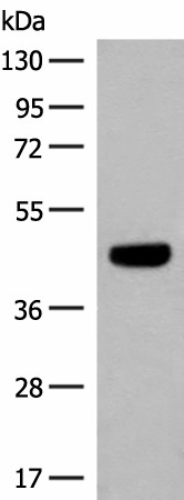 GNAT1 Polyclonal Antibody (E-AB-18009)