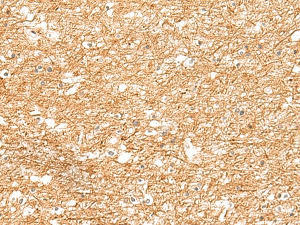 ZNF185 Polyclonal Antibody (E-AB-19367)