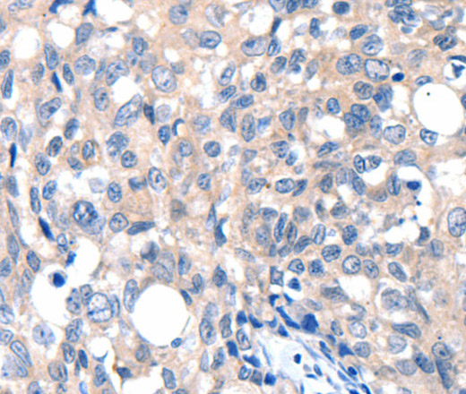 GRIN2D Polyclonal Antibody (E-AB-15809)