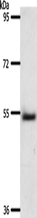 A1BG Polyclonal Antibody (E-AB-16125)