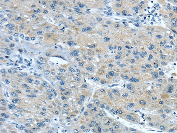 TNIP1 Polyclonal Antibody (E-AB-17464)