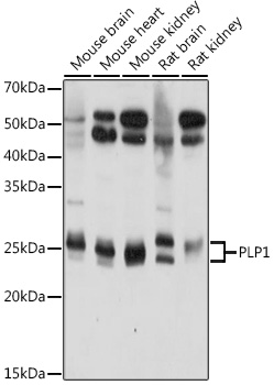 PLP1 Polyclonal Antibody (E-AB-92166)