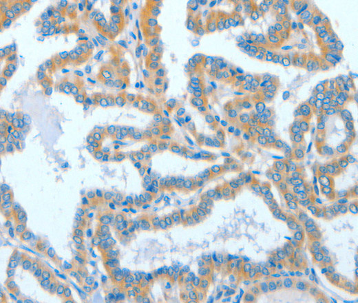 ASCC1 Polyclonal Antibody (E-AB-14751)