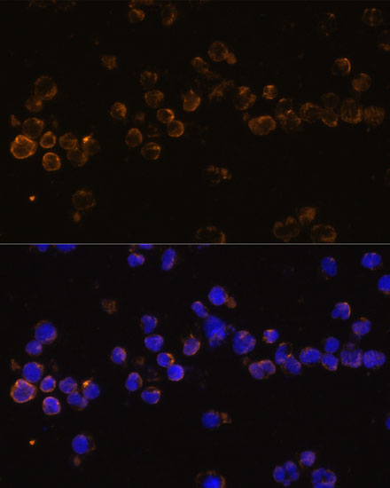 KLRC4 Polyclonal Antibody (E-AB-65113)