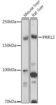 PRR12 Polyclonal Antibody (E-AB-92294)