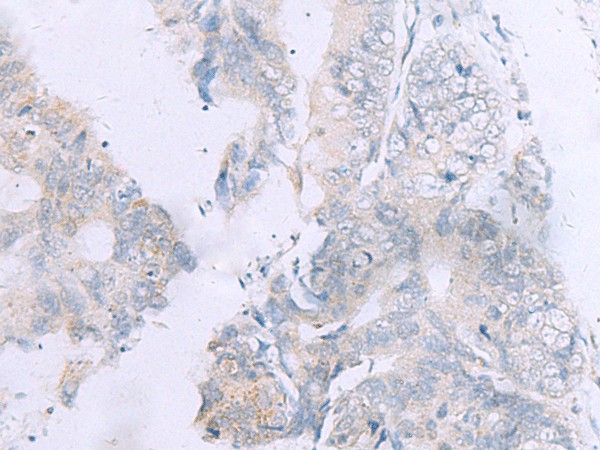 GPC3 Polyclonal Antibody (E-AB-53438)