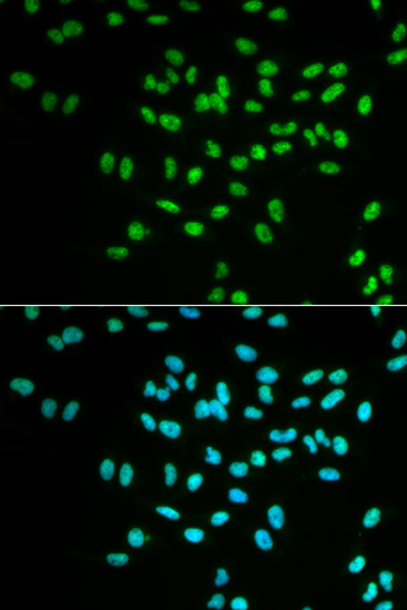 FANCD2 Polyclonal Antibody (E-AB-60589)