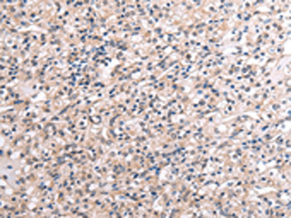 RNF115 Polyclonal Antibody (E-AB-18328)