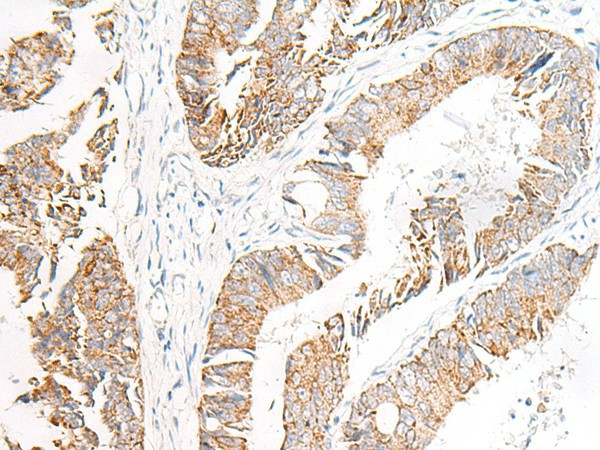 FGR Polyclonal Antibody (E-AB-19870)
