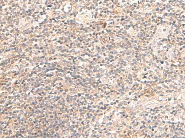TRAPPC1 Polyclonal Antibody (E-AB-18974)
