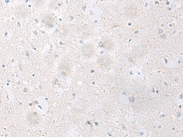 SST Polyclonal Antibody (E-AB-53515)