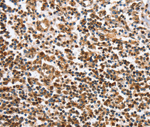 IRAK3 Polyclonal Antibody (E-AB-14167)