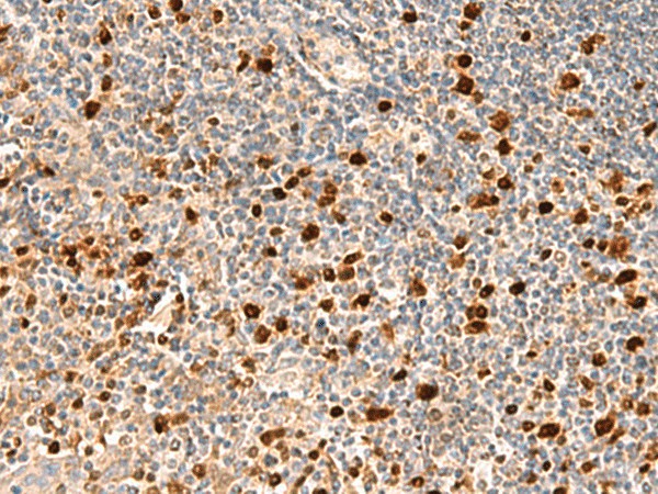 DUT Polyclonal Antibody (E-AB-18984)