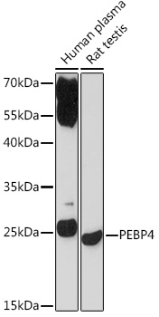 PEBP4 Polyclonal Antibody (E-AB-91965)