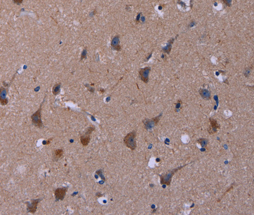 TUBGCP2 Polyclonal Antibody (E-AB-13262)