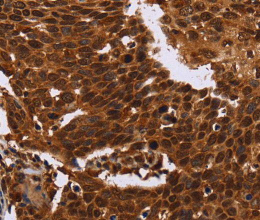 FANCF Polyclonal Antibody (E-AB-11216)