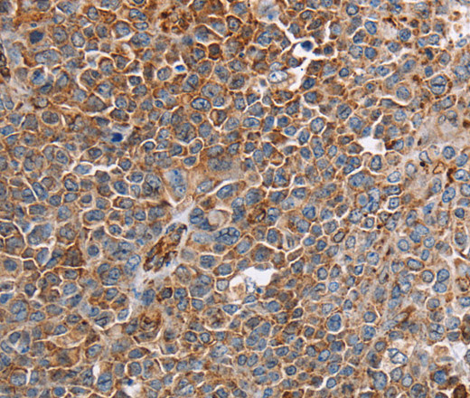 PLXNA2 Polyclonal Antibody (E-AB-13521)