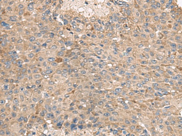 ABCA10 Polyclonal Antibody (E-AB-18179)