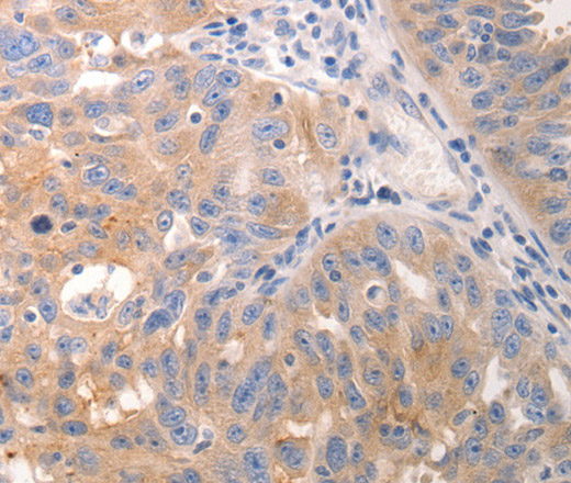CK-6A/B/C Polyclonal Antibody (E-AB-15555)