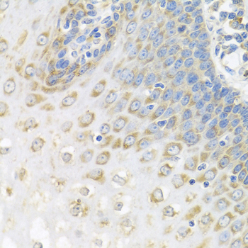 PABPC4 Polyclonal Antibody (E-AB-62287)