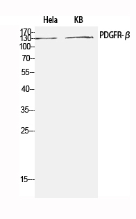 PDGFRB Polyclonal Antibody (E-AB-32531)