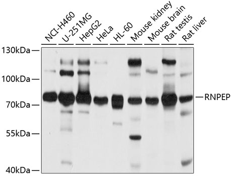 RNPEP Polyclonal Antibody (E-AB-92568)