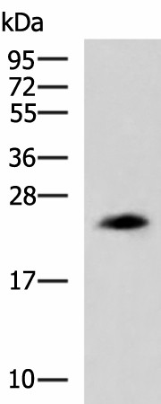 CLTB Polyclonal Antibody (E-AB-19170)