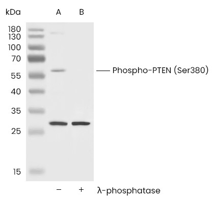 Recombinant Phospho-PTEN (Ser380) Monoclonal Antibody (AN300147L)
