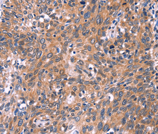 EDN1 Polyclonal Antibody (E-AB-10314)
