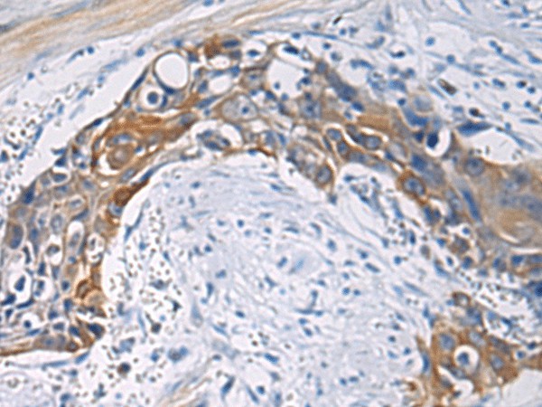CEP89 Polyclonal Antibody (E-AB-53169)
