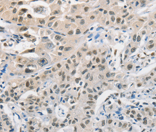 CDC27 Polyclonal Antibody (E-AB-13987)