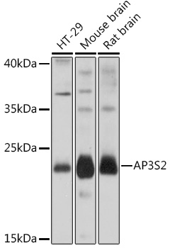 AP3S2 Polyclonal Antibody (E-AB-91830)