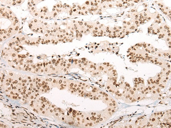 VPS51 Polyclonal Antibody (E-AB-17740)