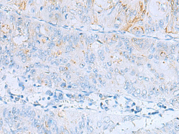 ERBB2 Polyclonal Antibody (E-AB-53244)