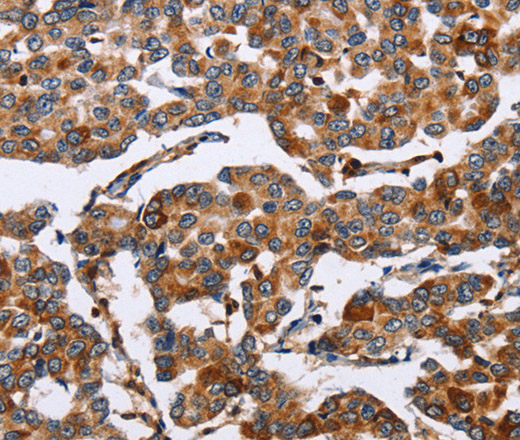 ENPP5 Polyclonal Antibody (E-AB-14060)