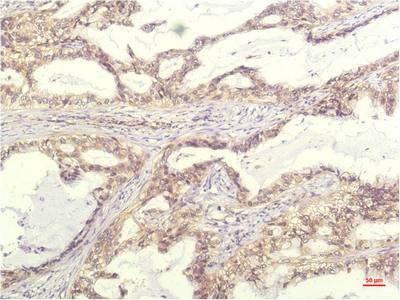 IL8 Monoclonal Antibody (E-AB-22204)