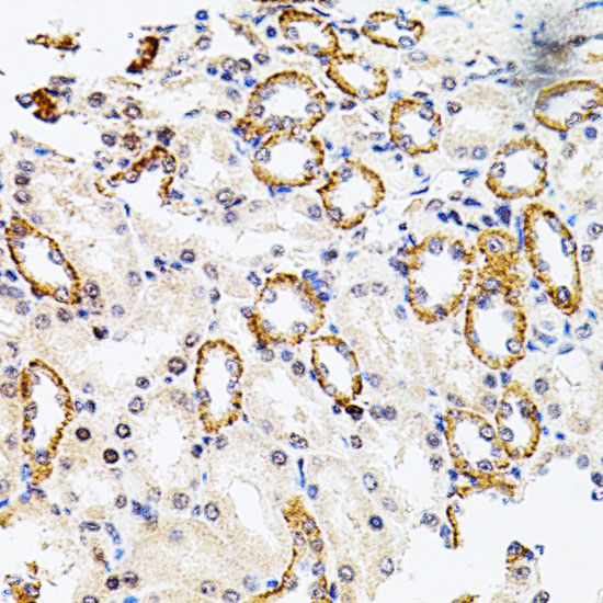 RPS6KA3 Polyclonal Antibody (E-AB-61798)