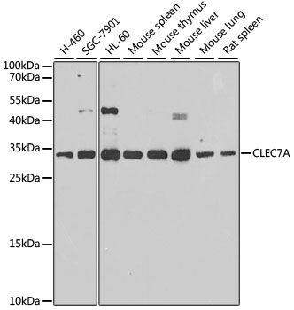 CLEC7A Polyclonal Antibody (E-AB-63167)