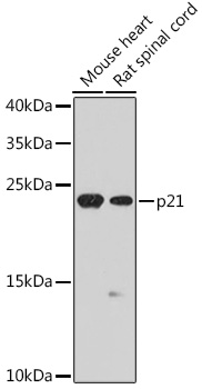 p21 Polyclonal Antibody (E-AB-66357)