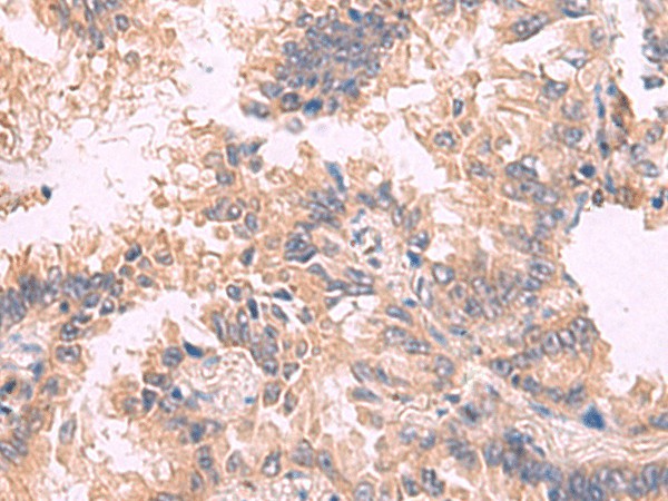 TJP1 Polyclonal Antibody (E-AB-52081)