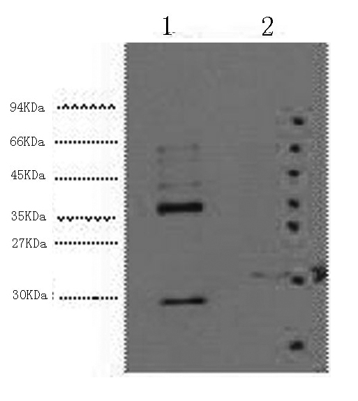 CA9 Monoclonal Antibody (E-AB-22034)