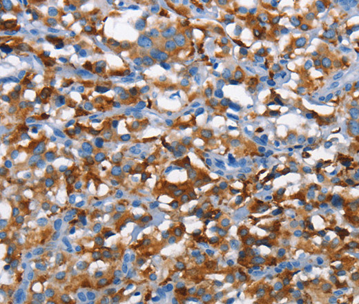 CD226 Polyclonal Antibody (E-AB-12777)