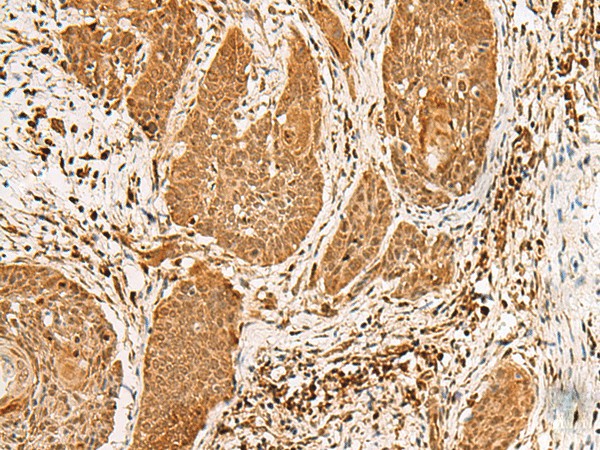 PPOX Polyclonal Antibody (E-AB-18840)