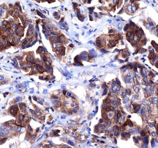 Recombinant HER4/ErbB4 Monoclonal Antibody (AN301872L)