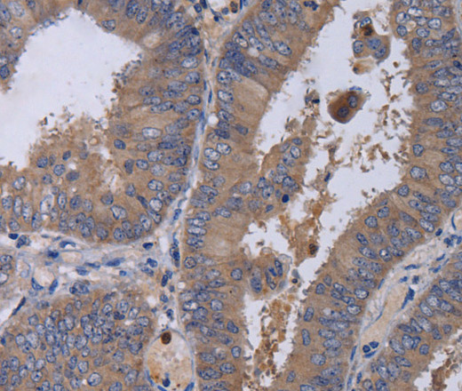 MKKS Polyclonal Antibody (E-AB-11401)