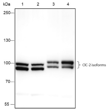 Recombinant ClC-2 Monoclonal Antibody (AN301722L)