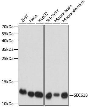 (KO Validated) SEC61B Polyclonal Antibody (E-AB-66577)