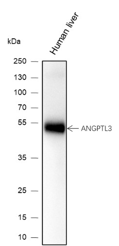 Recombinant ANGPTL3 Monoclonal Antibody (AN301438L)