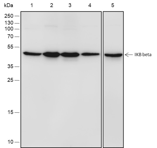 Recombinant IKB beta Monoclonal Antibody (AN301851L)